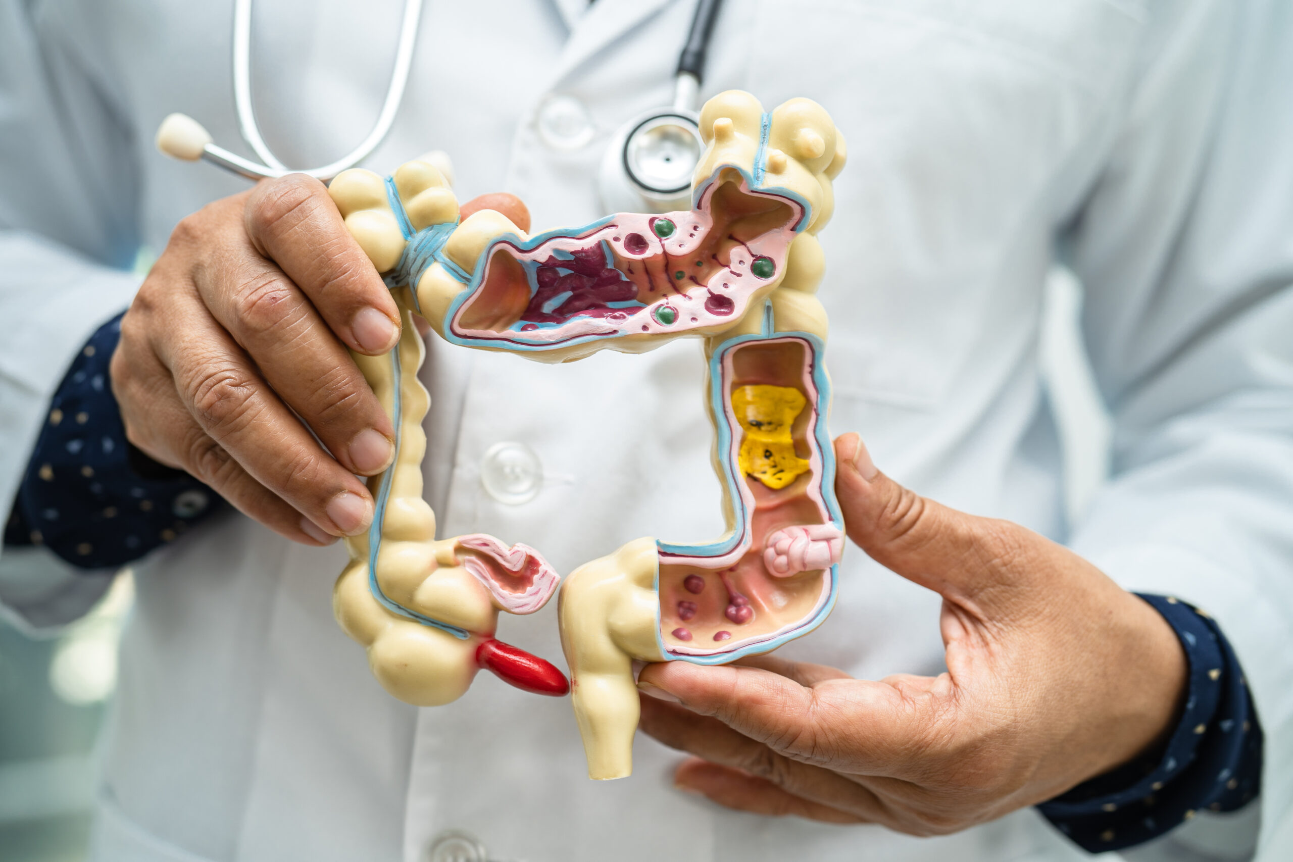 A doctor displays a detailed anatomical model of the human colon, emphasizing various sections and features vital for promoting optimal gut health.